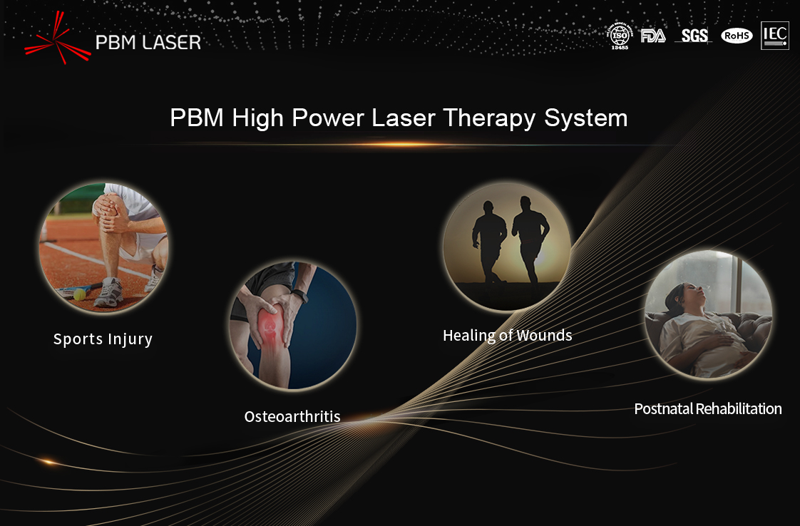 Prinsip dan Kajian Kes Pemulihan Senaman dengan Laser Tenaga Tinggi oleh Laser Perubatan PBM - Laporan Sorotan Mesyuarat Tahunan Perubatan Pemulihan